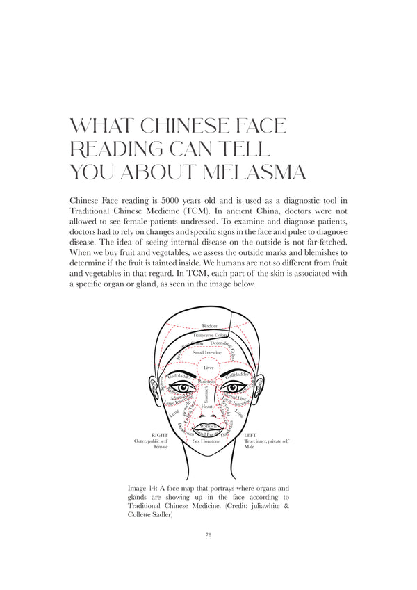 The Truth About Melasma by Janett Juwien