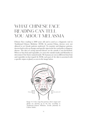 The Truth About Melasma by Janett Juwien